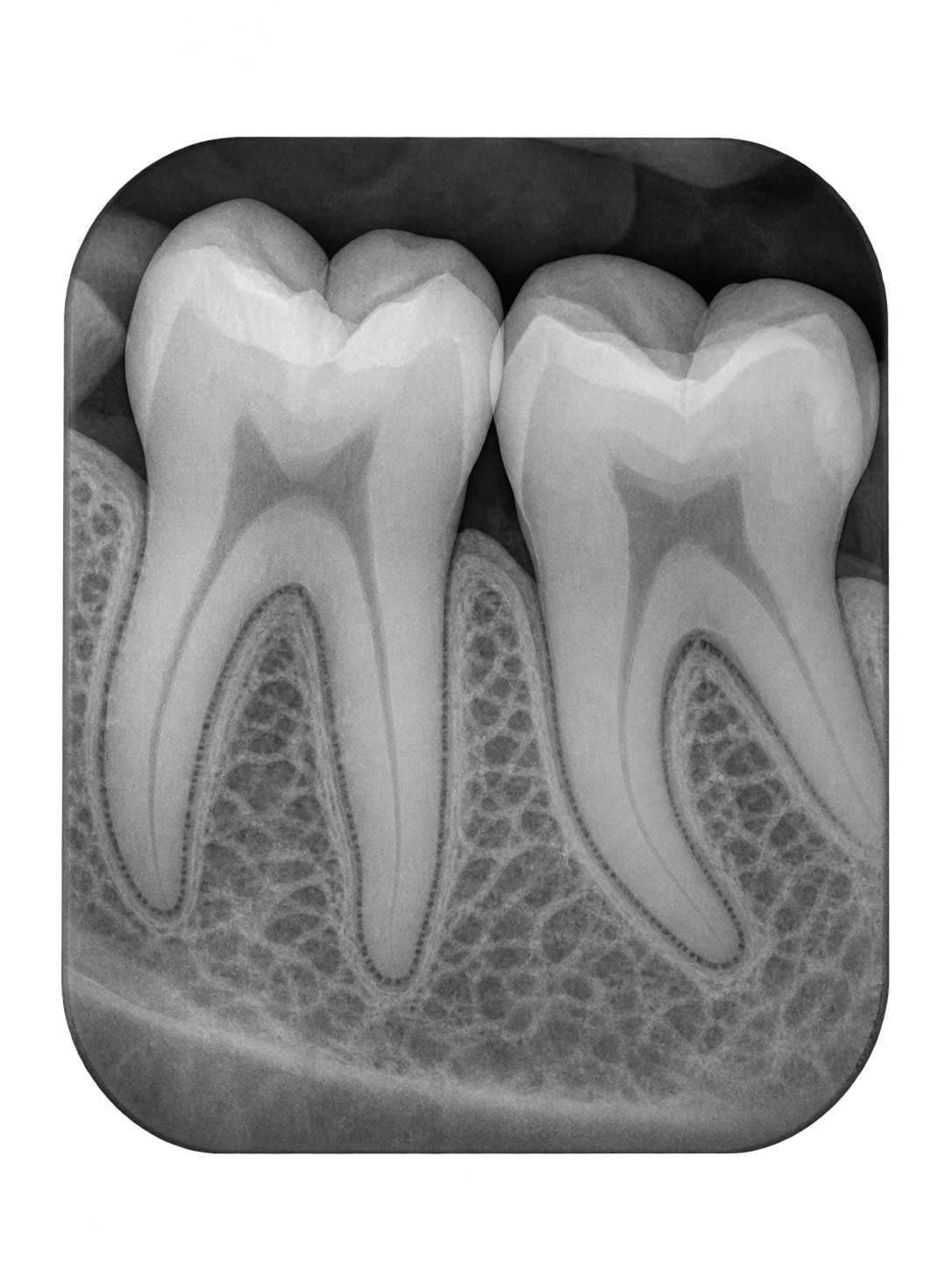 Radiografía periapical dental del perfil de ejemplo