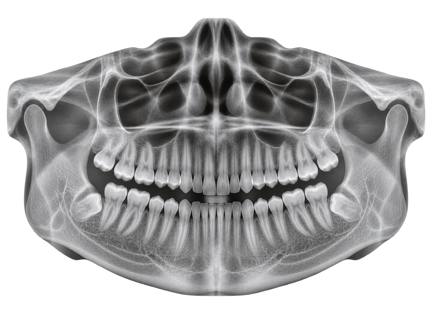 Radiografía panorámica dental del perfil de ejemplo